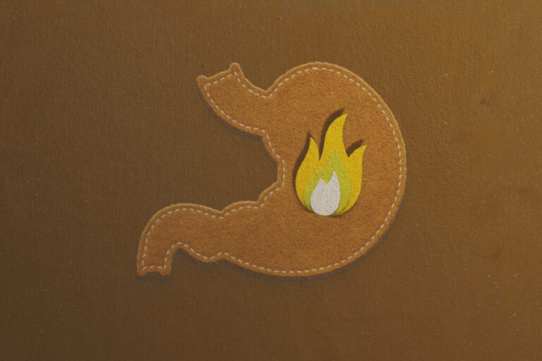 Les 10 pires aliments pour le reflux acide
