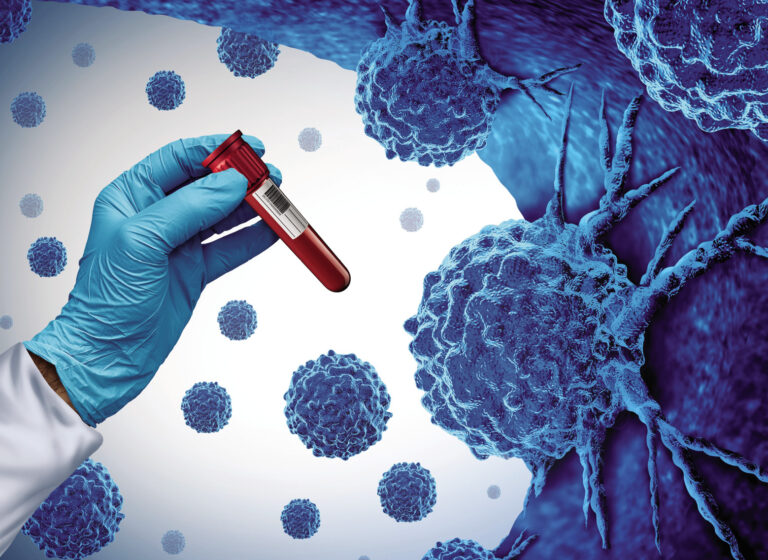 Grande percée dans la détection du cancer
