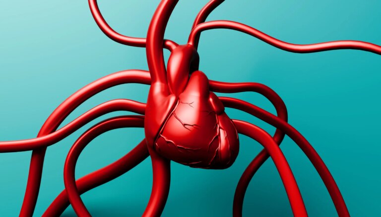 arterial calcification