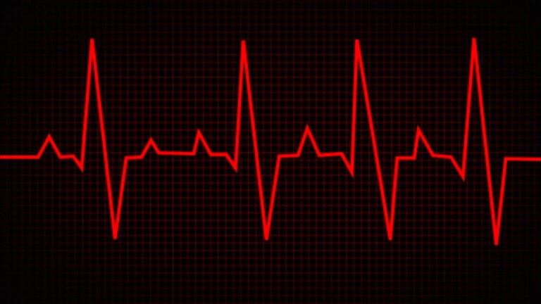 afib