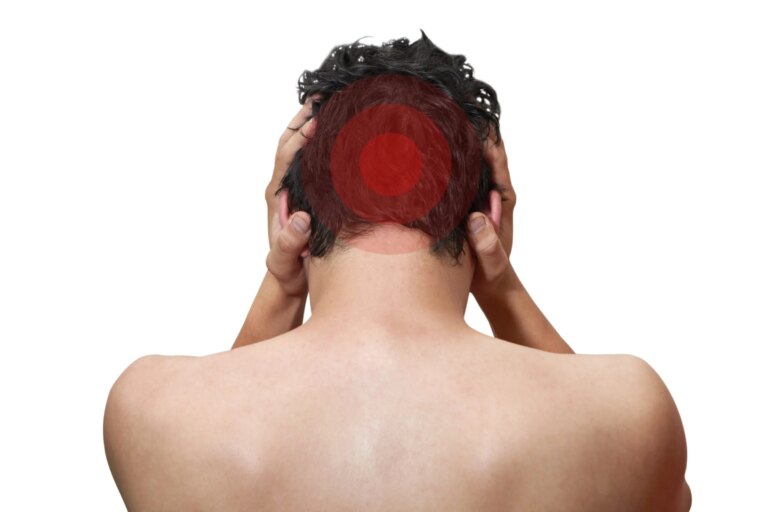 Back of Head Headaches