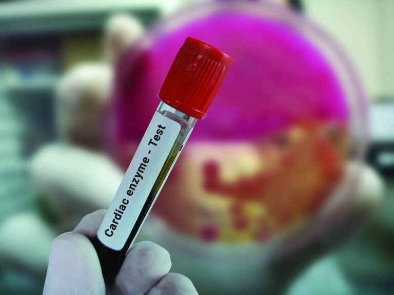 cardiac biomarkers
